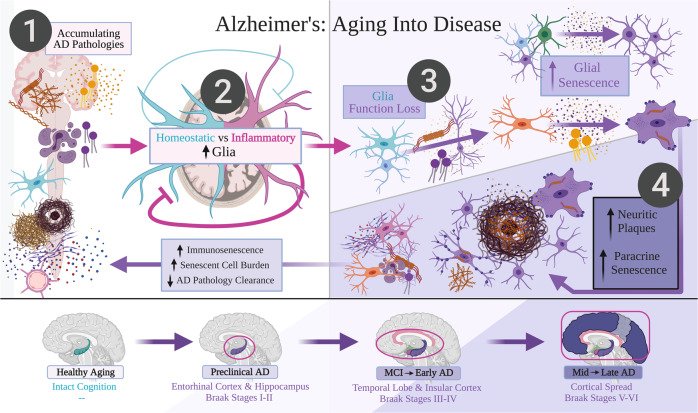 Alzheimer’s: aging into disease. A late-onset Alzheimer’s disease (LOAD)