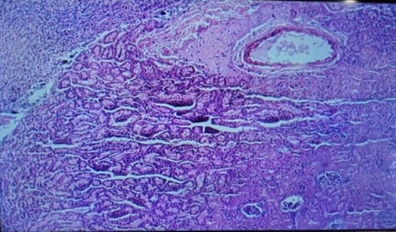 Kidney