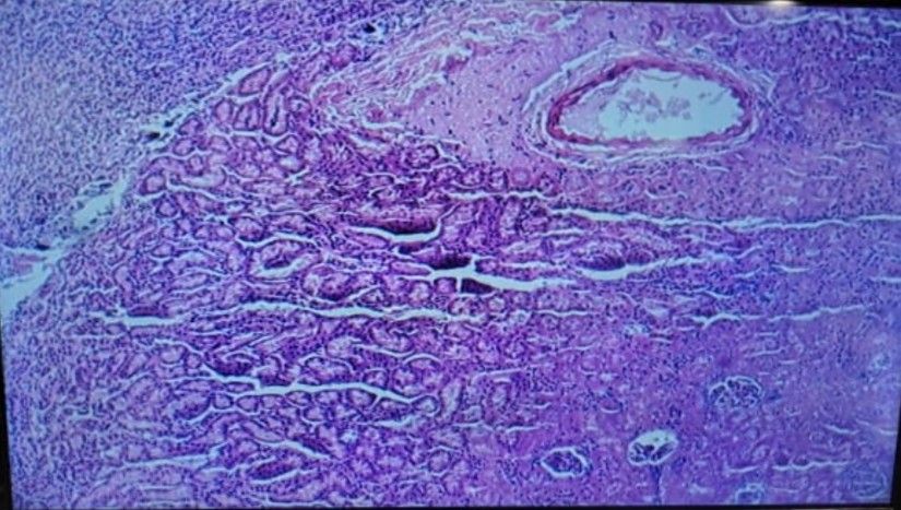 Kidney