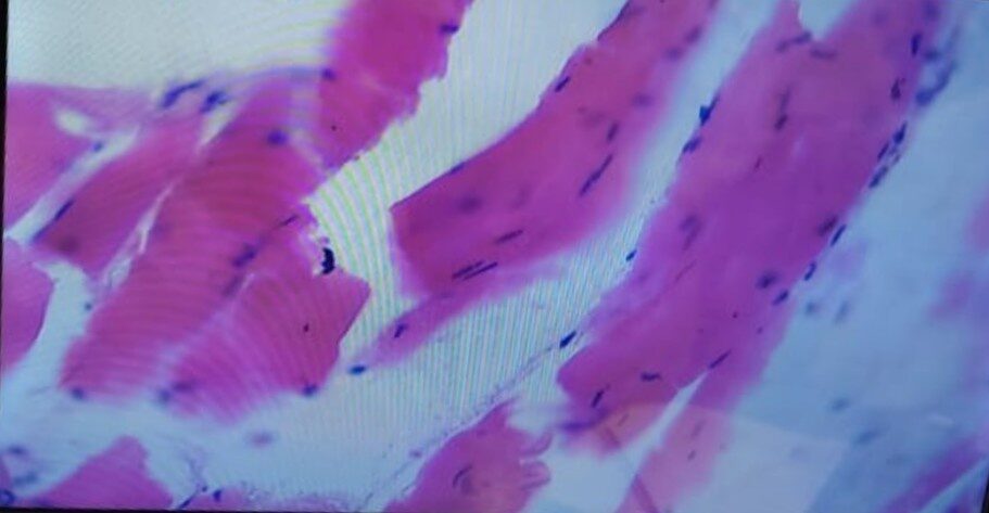 A2469C Principles of Histotechnology and Cytotechnology Assignment: Special Stain Report and Cytological Processing Case Study Comparison